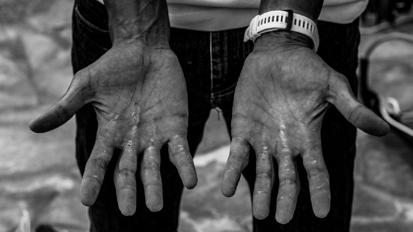 Behind the Flame: ολοκληρώθηκε η έκθεση του Νίκου Ζήκου στην Τεχνόπολη Δήμου Αθηναίων