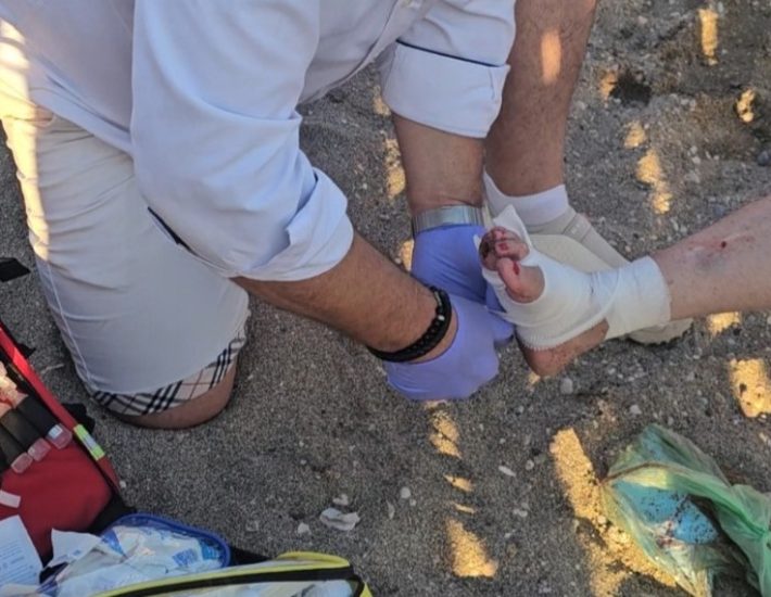 Ανάβυσσος: Γιατί η θαλάσσια χελώνα επιτέθηκε σε λουόμενη – Τι εξηγεί ο ΑΡΧΕΛΩΝ