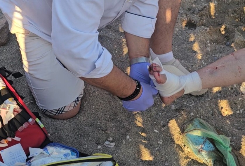 Ανάβυσσος: Γιατί η θαλάσσια χελώνα επιτέθηκε σε λουόμενη – Τι εξηγεί ο ΑΡΧΕΛΩΝ